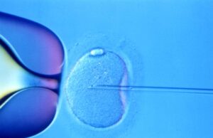 Affording the High Cost of Fertility Treatment